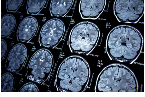 Neurochirurgie